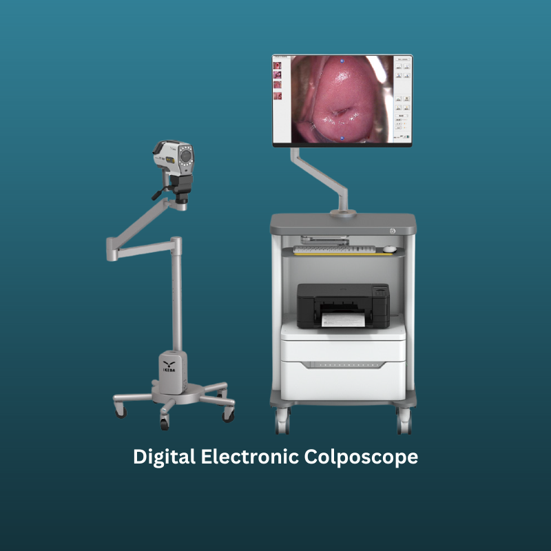 Digital Electronic Colposcope