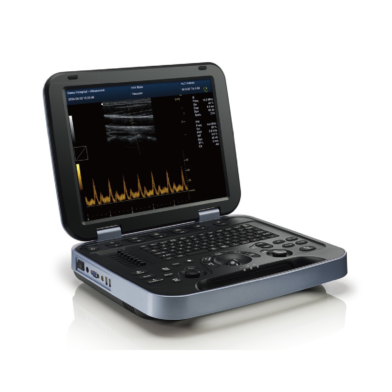Periodmed PU-DL151A Portable Ultrasound, Convex Probe