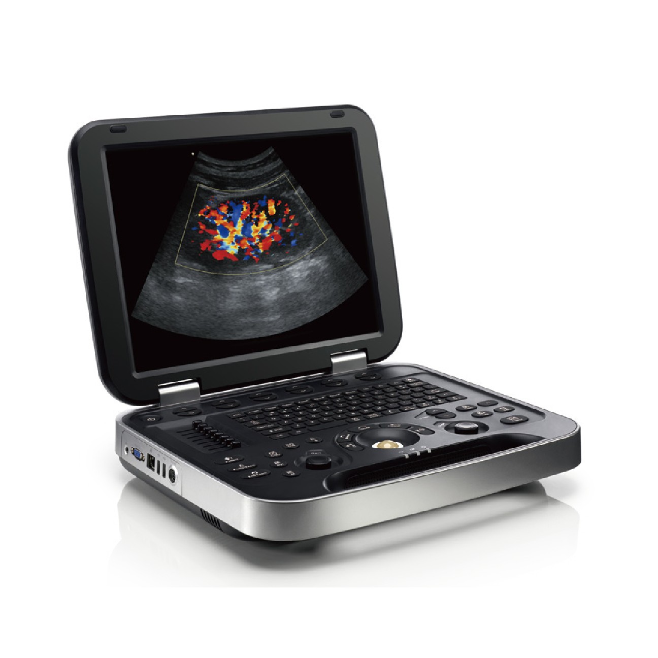Periodmed PU-L152B Portable Colour Doppler Ultrasound, Convex + Linear Probes